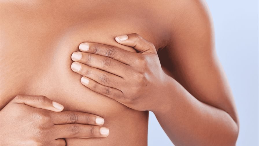 Cáncer de mama hereditario: cuando la respuesta está en tus genes