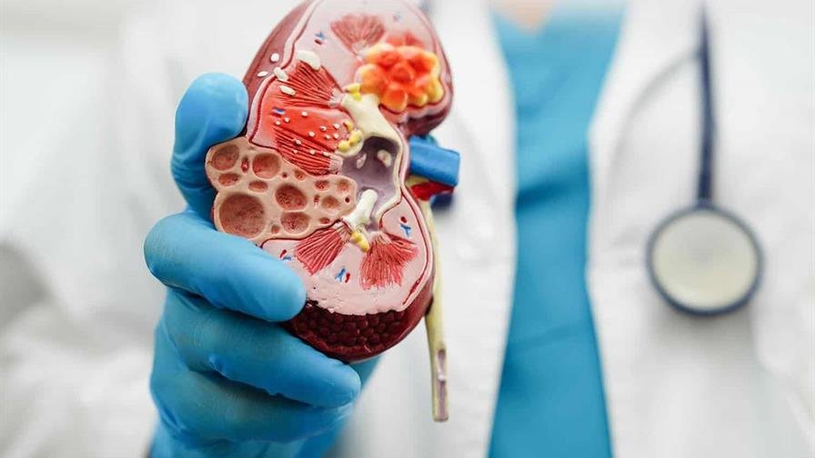 La enfermedad renal crónica es la novena causa principal de muerte en el mundo