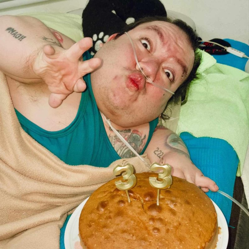 El tiktoker Alejo Little falleció a los 33 años tras luchar contra una enfermedad genética